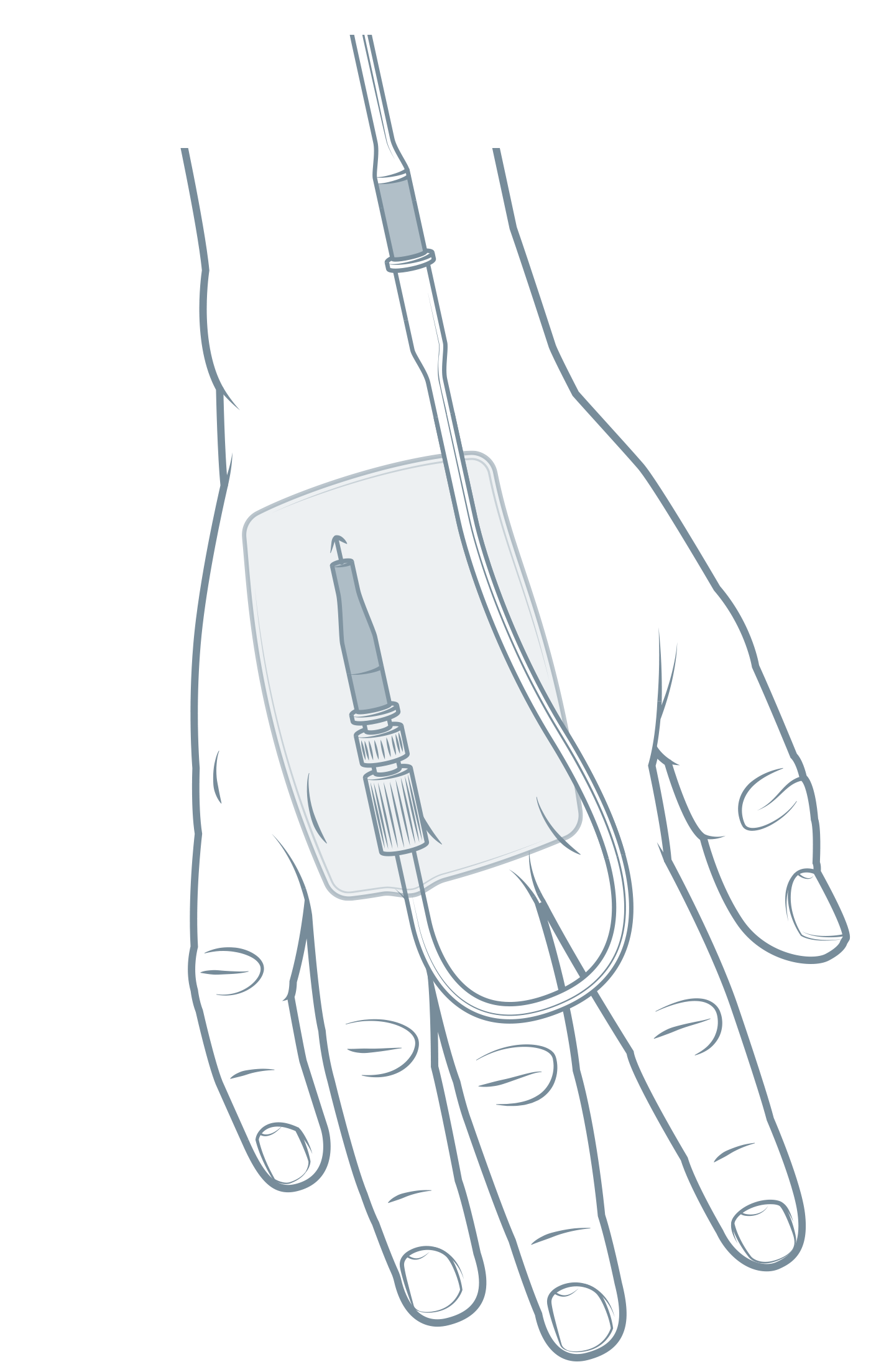 Peripheral intravenous catheters 22